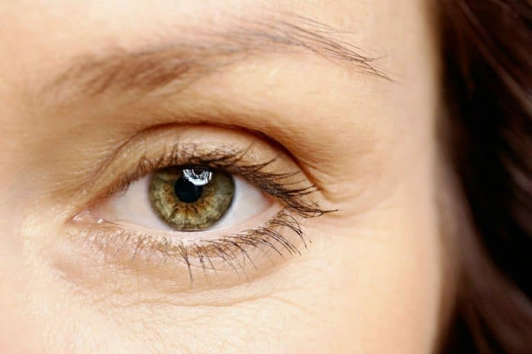 Close-up of a woman’s eye with a visibly thinning eyebrow and sparse brow hair